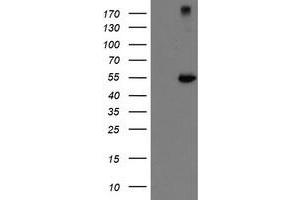 Western Blotting (WB) image for anti-rho GTPase Activating Protein 2 (ARHGAP2) antibody (ABIN1499629) (CHN1 antibody)