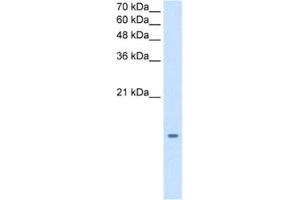Western Blotting (WB) image for anti-Microsomal Glutathione S-Transferase 2 (MGST2) antibody (ABIN2462839)