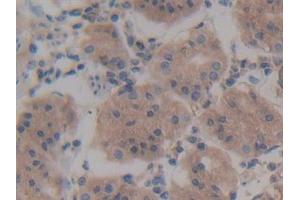 Detection of Rock2 in Human Stomach Tissue using Polyclonal Antibody to Rho Associated Coiled Coil Containing Protein Kinase 2 (Rock2) (ROCK2 antibody  (AA 904-1140))