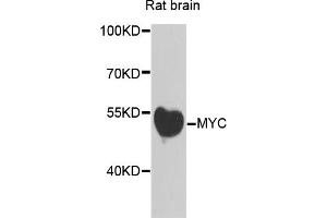 Western blot analysis of extracts of rat brain, using MYC antibody (ABIN5996012) at 1/500 dilution. (c-MYC antibody)
