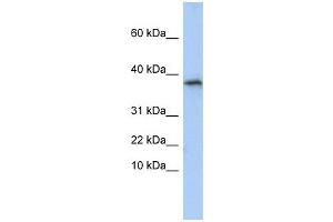 GLYAT antibody used at 1 ug/ml to detect target protein. (GLYAT antibody  (N-Term))