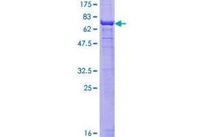 Smooth Muscle Actin Protein (AA 1-377) (GST tag)