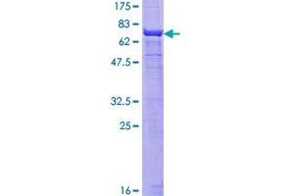 Smooth Muscle Actin Protein (AA 1-377) (GST tag)