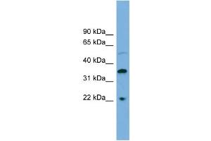 WB Suggested Anti-DOK6 Antibody Titration: 0. (DOK6 antibody  (Middle Region))