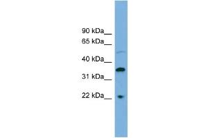 WB Suggested Anti-DOK6 Antibody Titration: 0.
