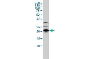 RHOJ monoclonal antibody (M01), clone 1E4 Western Blot analysis of RHOJ expression in HepG2 (RHOJ antibody  (AA 1-214))