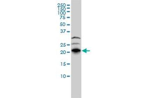 RHOJ anticorps  (AA 1-214)