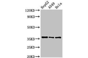 Western Blot Positive WB detected in: HepG2 whole cell lysate, A549 whole cell lysate, Hela whole cell lysate All lanes: ECH1 antibody at 2. (ECH1 antibody  (AA 36-135))