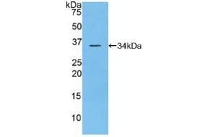 Detection of Recombinant DEP1, Mouse using Polyclonal Antibody to Density Enhanced Phosphatase 1 (DEP1) (PTPRJ antibody  (AA 567-842))