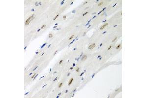 Immunohistochemistry of paraffin-embedded mouse heart using CDC27 antibody (ABIN5975347) at dilution of 1/200 (40x lens). (CDC27 antibody)