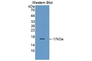 Western blot analysis of the recombinant protein. (VEGFB antibody  (AA 22-137))
