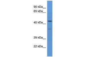 Western Blotting (WB) image for anti-Wolf-Hirschhorn Syndrome Candidate 2 (WHSC2) (N-Term) antibody (ABIN2788623) (WHSC2 antibody  (N-Term))