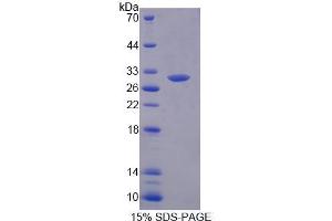 SDS-PAGE analysis of Human MED8 Protein.