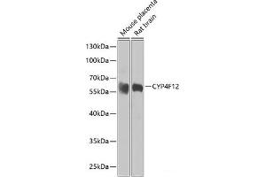 Western blot analysis of extracts of various cell lines using CYP4F12 Polyclonal Antibody at dilution of 1:1000. (CYP4F12 antibody)