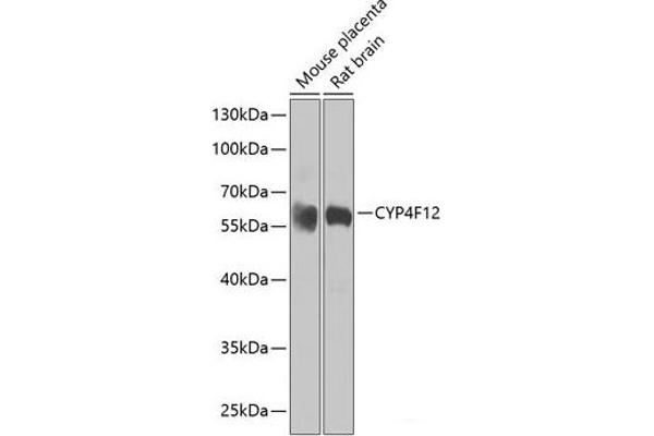 CYP4F12 抗体