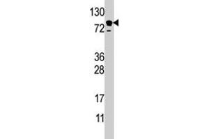 Western blot analysis of EPS15 polyclonal antibody  in HL-60 cell line lysate (35 ug/lane). (EPS15 antibody  (C-Term))