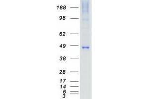 Validation with Western Blot