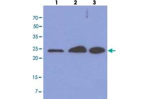 Western blot analysis of cell lysates (each 40 ug) by MRRF monoclonal antibody, clone AT7D10  (1:1000). (MRRF antibody  (AA 56-262))