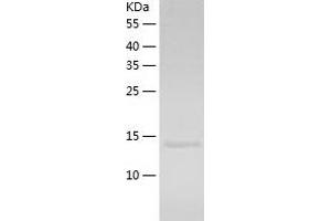 TRAF1 Protein (AA 266-416) (His tag)