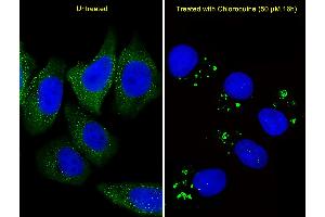 Fluorescent image of  cells stained with ATG5 Antibody (C-term) (ABIN388519 and ABIN2849632).