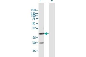 Western Blot analysis of DUT expression in transfected 293T cell line by DUT MaxPab polyclonal antibody. (Deoxyuridine Triphosphatase (DUT) (AA 1-252) antibody)