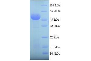SDS-PAGE (SDS) image for Sulfite Oxidase (SUOX) (AA 80-545) protein (His tag) (ABIN4976194)