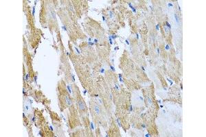 Immunohistochemistry of paraffin-embedded Rat heart using CCM2 Polyclonal Antibody at dilution of 1:100 (40x lens).