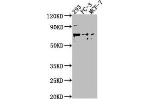 Western Blot Positive WB detected in: 293 whole cell lysate, PC-3 whole cell lysate, MCF-7 whole cell lysate All lanes: GPR37 antibody at 1:2000 Secondary Goat polyclonal to rabbit IgG at 1/50000 dilution Predicted band size: 68 kDa Observed band size: 68 kDa (GPR37 antibody  (AA 114-133))