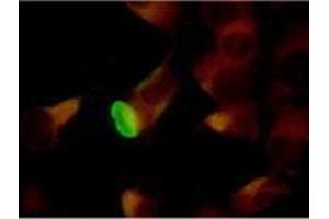 Immunofluorescence (IF) image for anti-Herpes Simplex Virus Type 2 ICP8 (HSV2 ICP8) antibody (ABIN265565) (HSV2 ICP8 antibody)