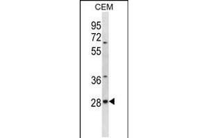 Western blot analysis in CEM cell line lysates (35ug/lane). (ALKBH4 antibody  (AA 88-117))