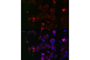 Immunofluorescence analysis of HepG2 cells using NOX1 Rabbit pAb (ABIN6133827, ABIN6144746, ABIN6144748 and ABIN6215916) at dilution of 1:50 (40x lens). (NOX1 antibody  (AA 200-300))