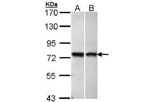 WB Image Sample (30 ug of whole cell lysate) A: A431 , B: Hela 7. (VPS51 antibody  (C-Term))