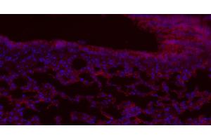 Paraformaldehyde-fixed, paraffin embedded mouse lung, Antigen retrieval by boiling in sodium citrate buffer (pH6. (CD8 antibody  (AA 51-150) (Alexa Fluor 555))