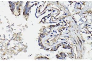 Immunohistochemistry of paraffin-embedded Human lung using WASF3 Polyclonal Antibody at dilution of 1:100 (40x lens). (WASF3 antibody)