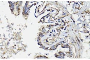 WASF3 antibody