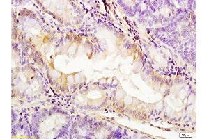 Formalin-fixed and paraffin embedded: rat colitis tissue labeled with Anti-PDGFRA Polyclonal Antibody, Unconjugated  at 1:200, followed by conjugation to the secondary antibody and DAB staining (PDGFRA antibody  (AA 1021-1089))