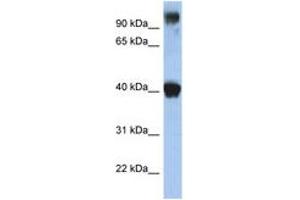 Image no. 1 for anti-Transcription Factor AP-2 epsilon (Activating Enhancer Binding Protein 2 Epsilon) (TFAP2E) (N-Term) antibody (ABIN6742240) (TFAP2E antibody  (N-Term))