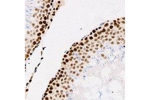 Immunohistochemical analysis of Importin alpha 1 staining in human testis formalin fixed paraffin embedded tissue section. (KPNA2 antibody)
