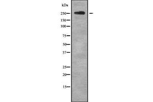 Western blot analysis of ABCA4 using HT29 whole cell lysates (ABCA4 antibody  (C-Term))