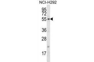 Western Blotting (WB) image for anti-F-Box Protein 15 (FBXO15) antibody (ABIN2996731) (FBXO15 antibody)