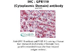 Image no. 2 for anti-G Protein-Coupled Receptor 119 (GPR119) (3rd Cytoplasmic Domain) antibody (ABIN1734912)