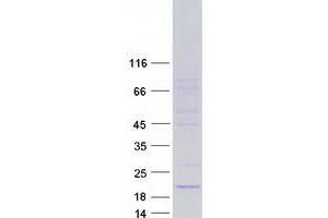 Validation with Western Blot (Aquaporin 1 Protein (Transcript Variant 4) (Myc-DYKDDDDK Tag))