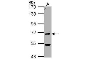 WB Image Sample (30 ug of whole cell lysate) A: Hela 7. (PAD4 antibody  (N-Term))