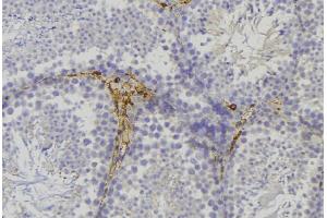ABIN6276747 at 1/100 staining Mouse testis tissue by IHC-P. (alpha Adducin antibody  (C-Term))