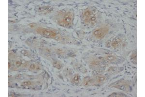 IHC(P): Rat Spleen Tissue. (KRT4 antibody)
