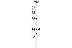 Western blot analysis of NSE4A Antibody (N-term) in WiDr cell line lysates (35µg/lane).