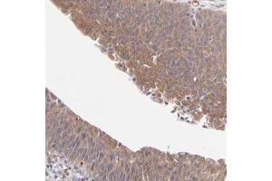 Immunohistochemical staining (Formalin-fixed paraffin-embedded sections) of human urinary bladder with ASB7 polyclonal antibody  shows moderate cytoplasmic positivity in urothelial cells. (ASB7 antibody)