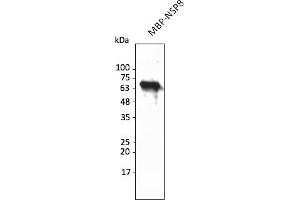 Western Blotting (WB) image for anti-SARS-CoV-2 Non-Structural Protein 8 (NSP8) antibody (ABIN7273001) (SARS-CoV-2 NSP8 antibody)