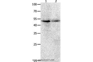 Western blot analysis of Jurkat cell  and human ovarian cancer tissue  , using KLF5 Polyclonal Antibody at dilution of 1:1700 (KLF5 antibody)