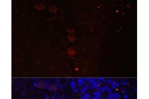 Immunofluorescence analysis of Rat brain using NEFM Polyclonal Antibody at dilution of 1:100. (NEFM antibody)